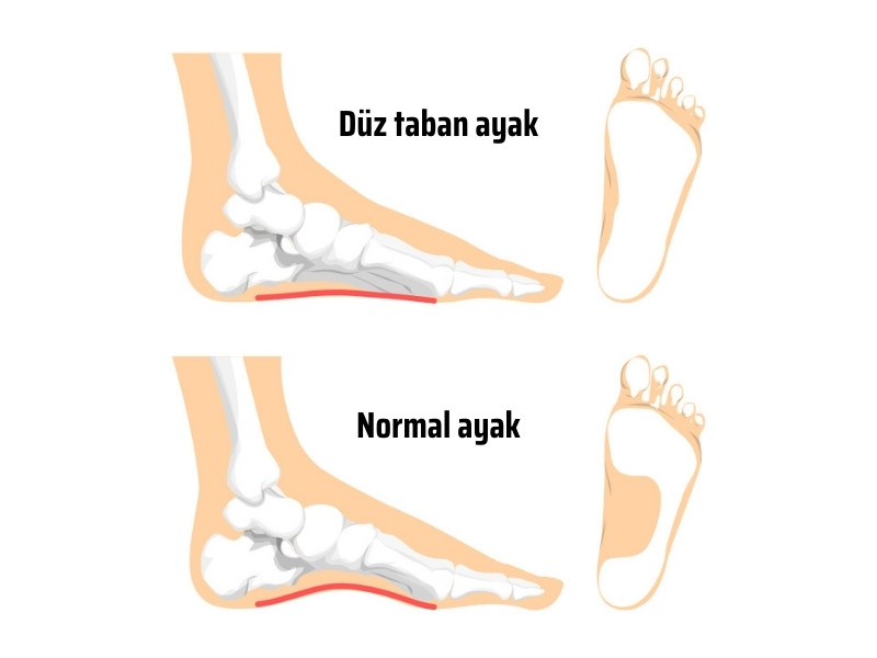duz taban sema